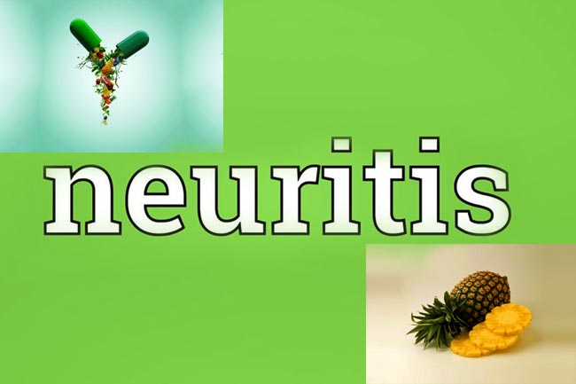क्या है नुराइटिस (neuritis)
