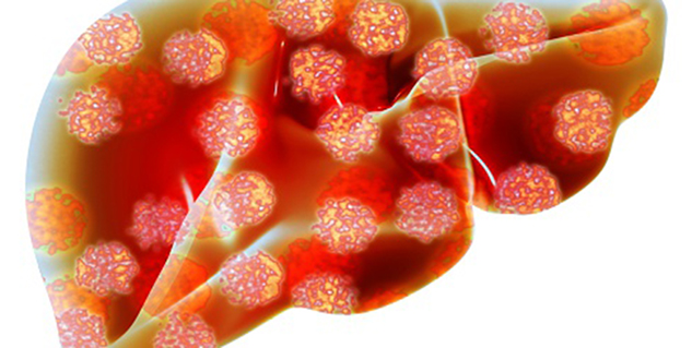 हेपेटाइटिस hepatitis in hindi