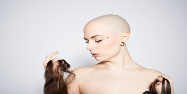 गंजापन baldness in hindi