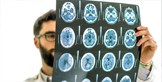 braincancer braincancer