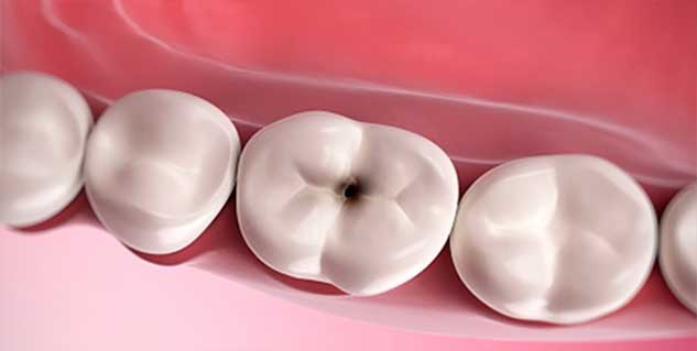 dentalcare dentalcare