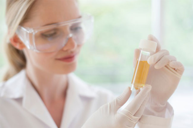 मूत्राशय कैंसर (Bladder Cancer)
