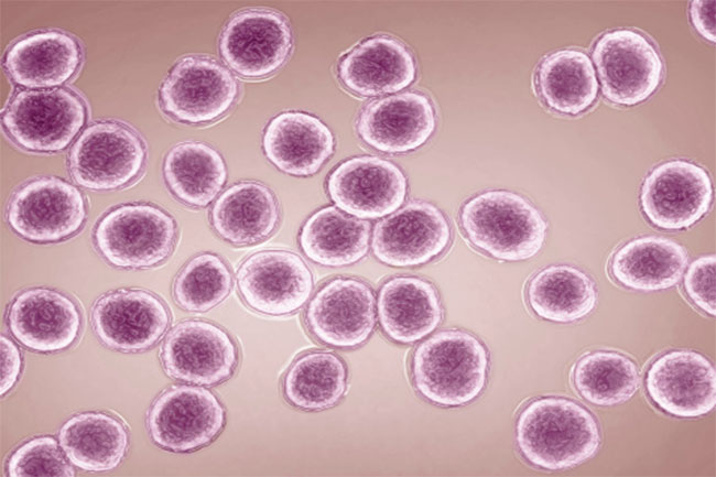 इंटर्स्टिशियल सिस्टिस (interstitial cystitis)
