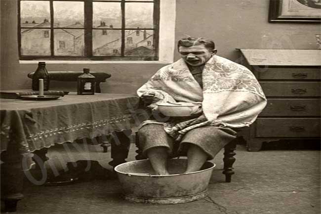 फ्रॉस्टबाइट प्रभावित क्षेत्र को कुनकुने पानी में डालें