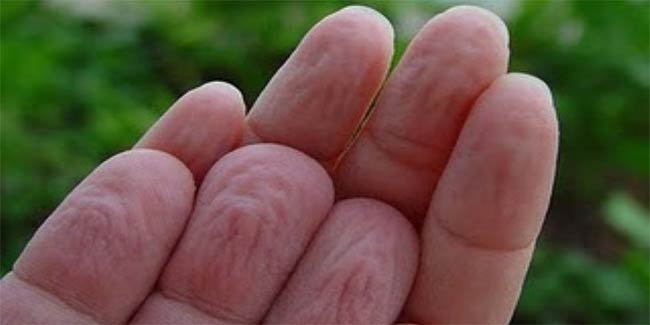 पानी में अधिक देर तक डालने से क्यों सिकुड़ जाती हैं उंगलियां
