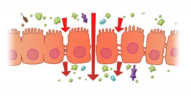 Leaky gut syndrome