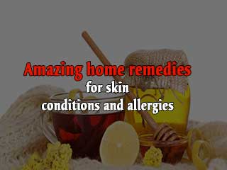 Amazing home remedies for skin conditions and allergies