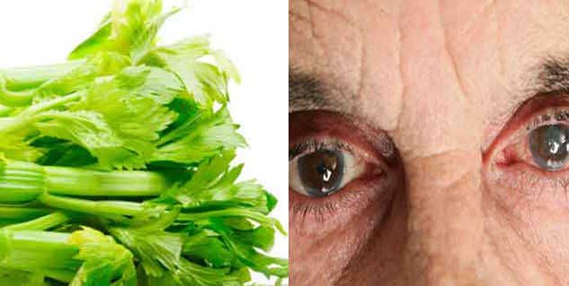 मोतियाबिंद cataracts in hindi