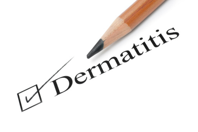 डर्मटाइटिस (Dermatitis)