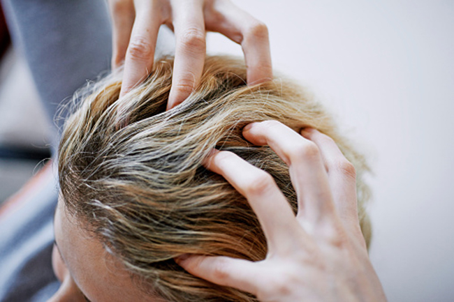 एग्जिमा के कारण (Seborrhoeic Eczema)