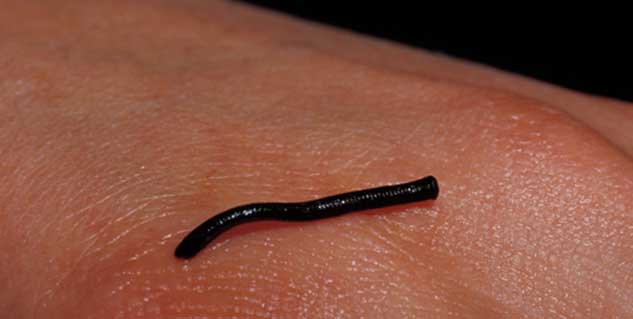 What is leech therapy used for?