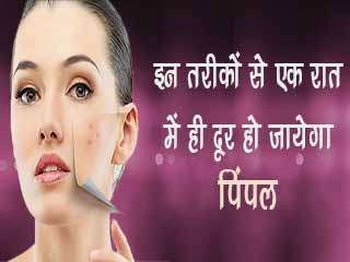 इन तरीकों से एक रात में ही दूर हो जायेगा पिंपल