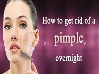 Tips To Get Rid Of Pimples Overnight