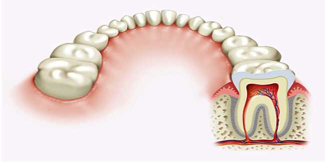 मसूड़ों के रोग से भी हो सकता है अल्जाइमर
