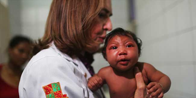 Zika virus may cause microcephaly even after birth