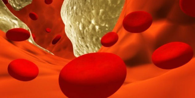 गुड कोलेस्ट्रॉल good cholesterol