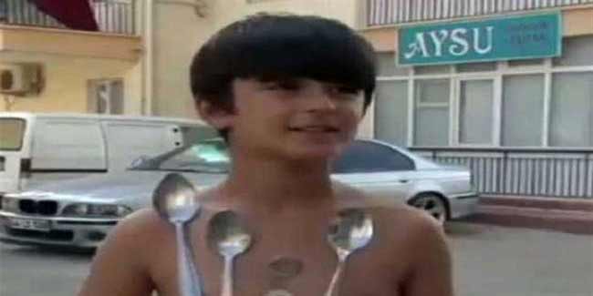 गुस्से में 'मैग्नेटिक बॉय' बन जाता है ये बच्चा, जानें कैसे