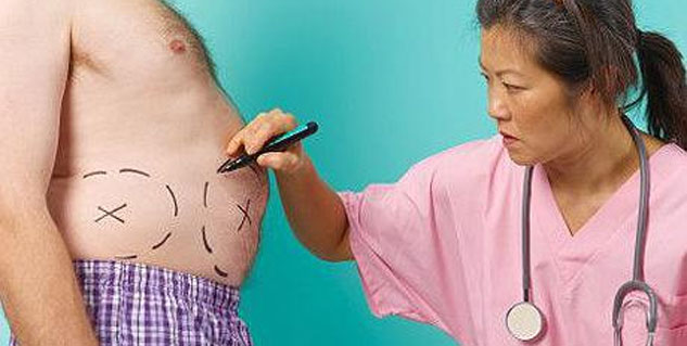 बैरियाट्रिक सर्जरी bariatric surgery