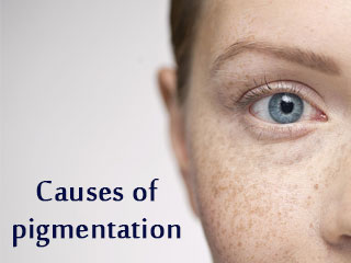 Causes of pigmentation