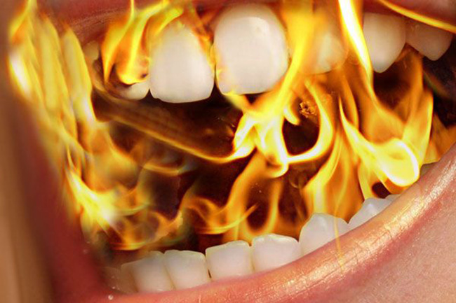 बर्निंग माउथ सिंड्रोम यानी बीएमएस (burning mouth syndrome)