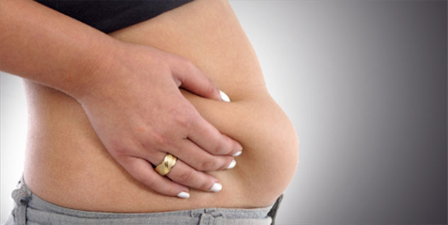 Abdominoplasty After Weight Loss Morbidly Obese Patients