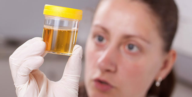 urine urine