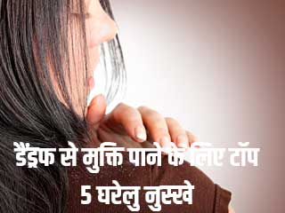 डैंड्रफ से मुक्ति पाने के लिए टॉप 5 घरेलु नुस्खे