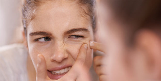 pimple acne marks pimple acne marks