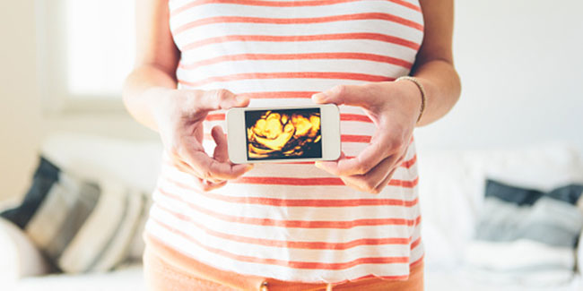 How to prevent stretch marks during pregnancy