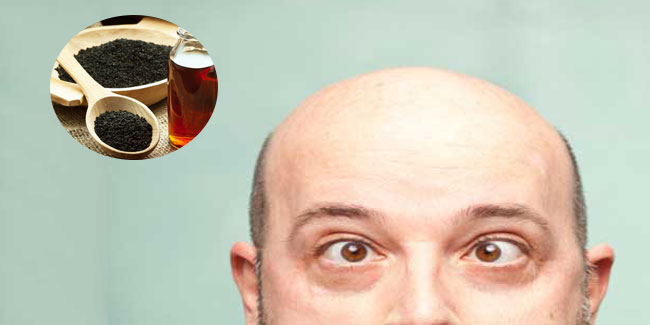 गंजों के लिए वरदान है ये उपाय, हफ्तेभर में आते हैं बाल!