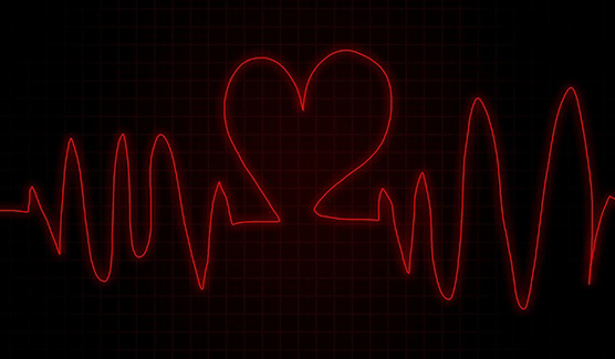 How is Coronary Angioplasty done?