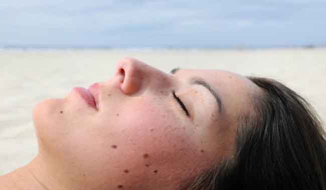 मिनटों में चेहरे के तिल से छुटकारा दिलाते हैं ये ब्यूटी टिप्स
