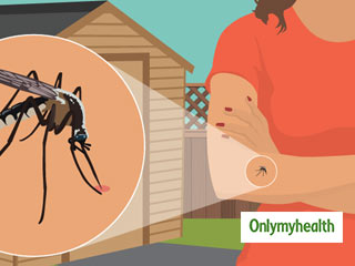 World Mosquito Day 2021: घर के अंदर और बाहर से मच्&zwj;छर भगाने के 5 तरीके