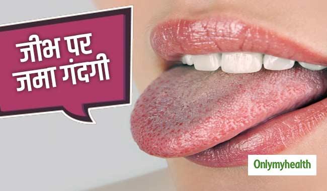 जीभ पर जमी गंदगी से होते हैं कई नुकसान, इन उपायों से आसानी से हटाएं