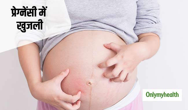 प्रेग्नेंसी में ज्यादा खुजली का कारण हो सकता है लिवर का आईसीपी रोग, जानें कारण और उपचार
