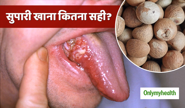 क्या सुपारी खाने से भी होता है कैंसर का खतरा? जानें कितनी सुरक्षित है सुपारी