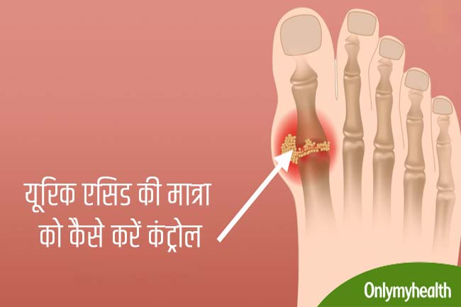 यूरिक एसिड को दूर करने वाले फूड