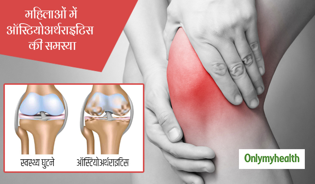 महिलाओं में मेनोपॉज के बाद क्यों बढ़ जाता है ऑस्टियोअर्थराइटिस का खतरा?