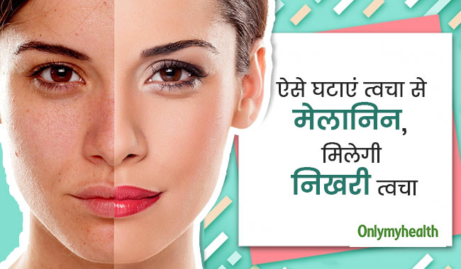 इन 5 नुस्खों से कम करें त्वचा का मेलानिन, निखरेगी त्वचा