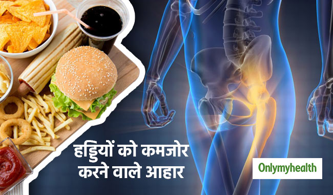 खान-पान की ये 8 गलत आदतें बना रही हैं आपकी हड्डियों को कमजोर