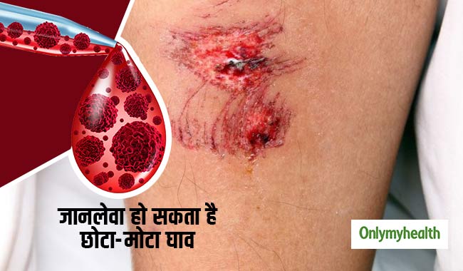 शरीर में छोटा सा घाव या इंफेक्शन हो बन सकता है जानलेवा, हो सकता है ये रोग