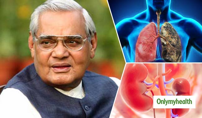 पूर्व प्रधानमंत्री अटल बिहारी की अचानक बिगड़ी तबीयत, हुई हैं ये बीमारियां