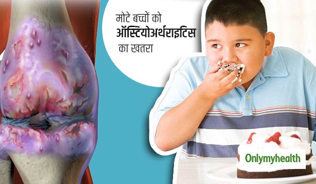 मोटे बच्चों को होता है ऑस्टियोअर्थराइटिस का खतरा, ऐसे कर सकते हैं बचाव