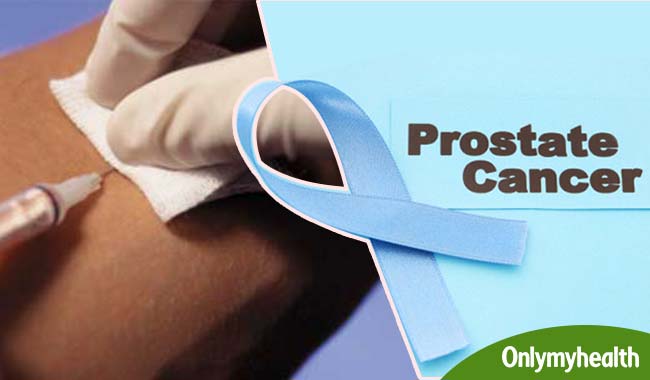 A Breakthrough in the Fight Against Prostate Cancer