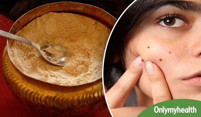 पिंपल्स होने पर लगाएं ये घरेलू चीज, निशान का भी होगा जड़ से सफाया