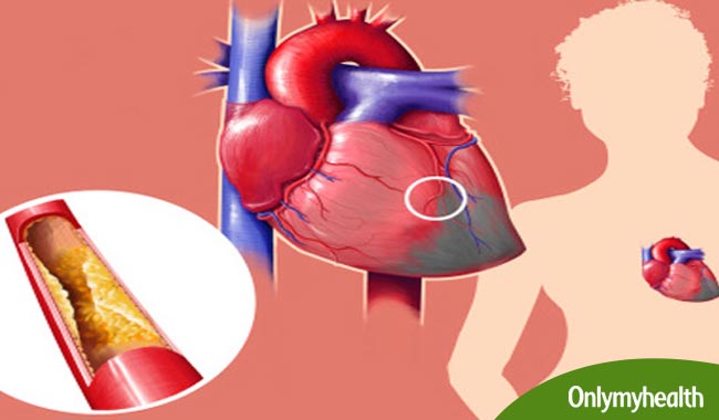 What are the Types of Coronary Artery Bypass Grafting?