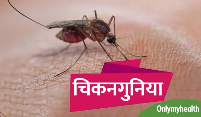 अब चिकनगुनिया से मिलेगी तुरंत निजात, आईआईटी के छात्रों ने बनाई दवा