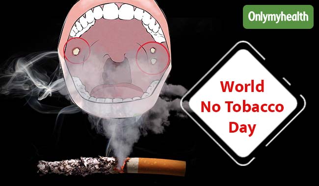 Tobacco Use Can Up your Risk of Developing Mouth Cancer: World No Tobacco Day