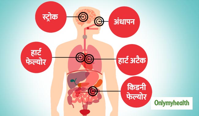 World Hypertension Day: शरीर के कई अंगों पर होता है हाई ब्लड प्रेशर का असर, जानें खतरे
