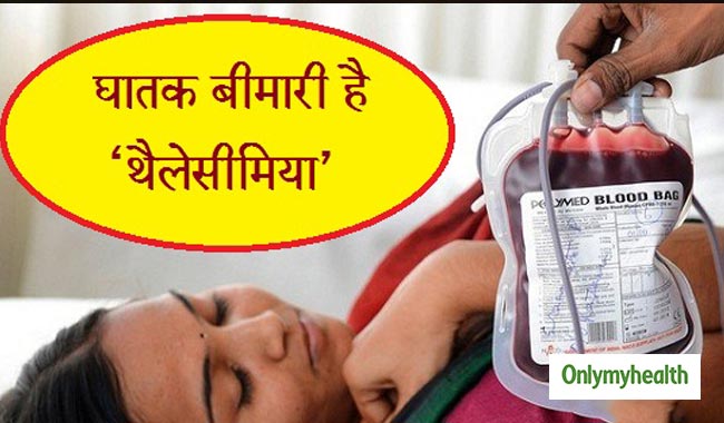 भारत में 5 करोड़ से ज्यादा लोग थैलेसीमिया के रोगी, जानें इसके लक्षण और इलाज